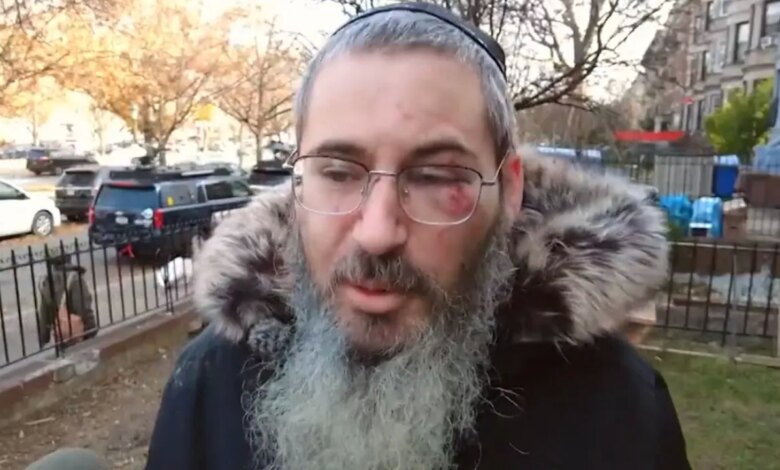 NYC Jewish man punched, robbed outside his home on first day of Hanukkah: ‘I want this person caught’