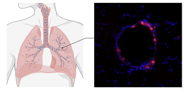 No Consent Necessary, Right Into The Lungs: Airborne mRNA Vaccines are Being Created