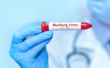 U.S. Ramps Up Screening Measures For Marburg Virus