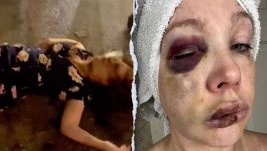 Cincinnati beatdown victim reveals ‘very bad brain trauma’ in first remarks since viral assault