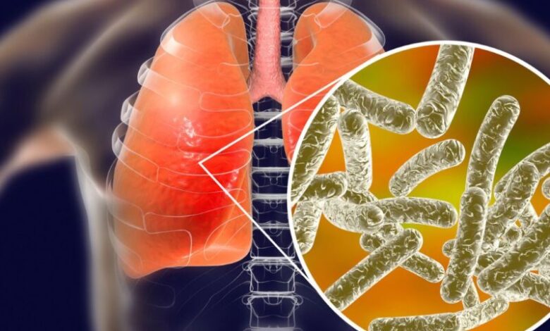 Two Die In Legionnaires Outbreak Two Die In Legionnaires Outbreak