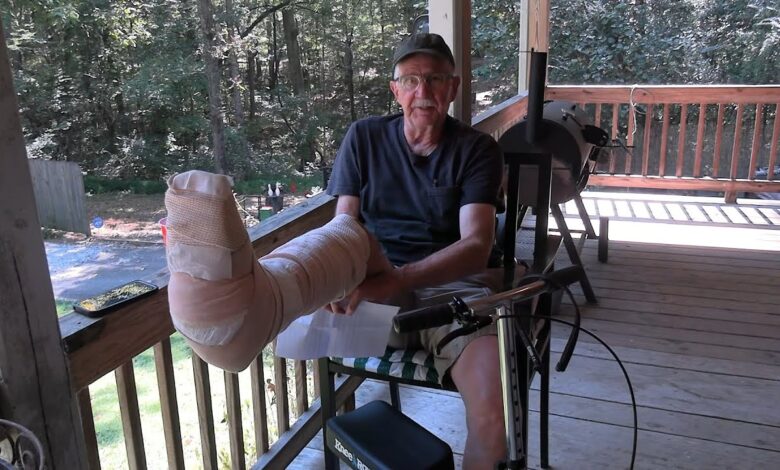 I Broke my Leg!