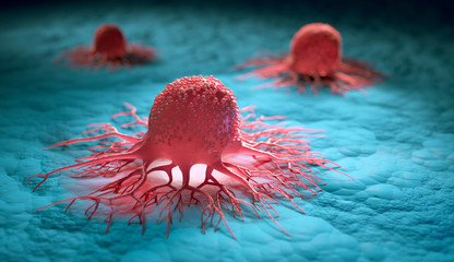 WHO Expects Cancer Cases To SOAR GLOBALLY WHO Expects Cancer Cases To SOAR GLOBALLY